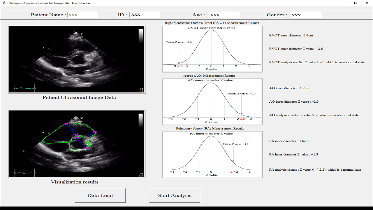 Infant CHD Intelligent Diagnosis Platform