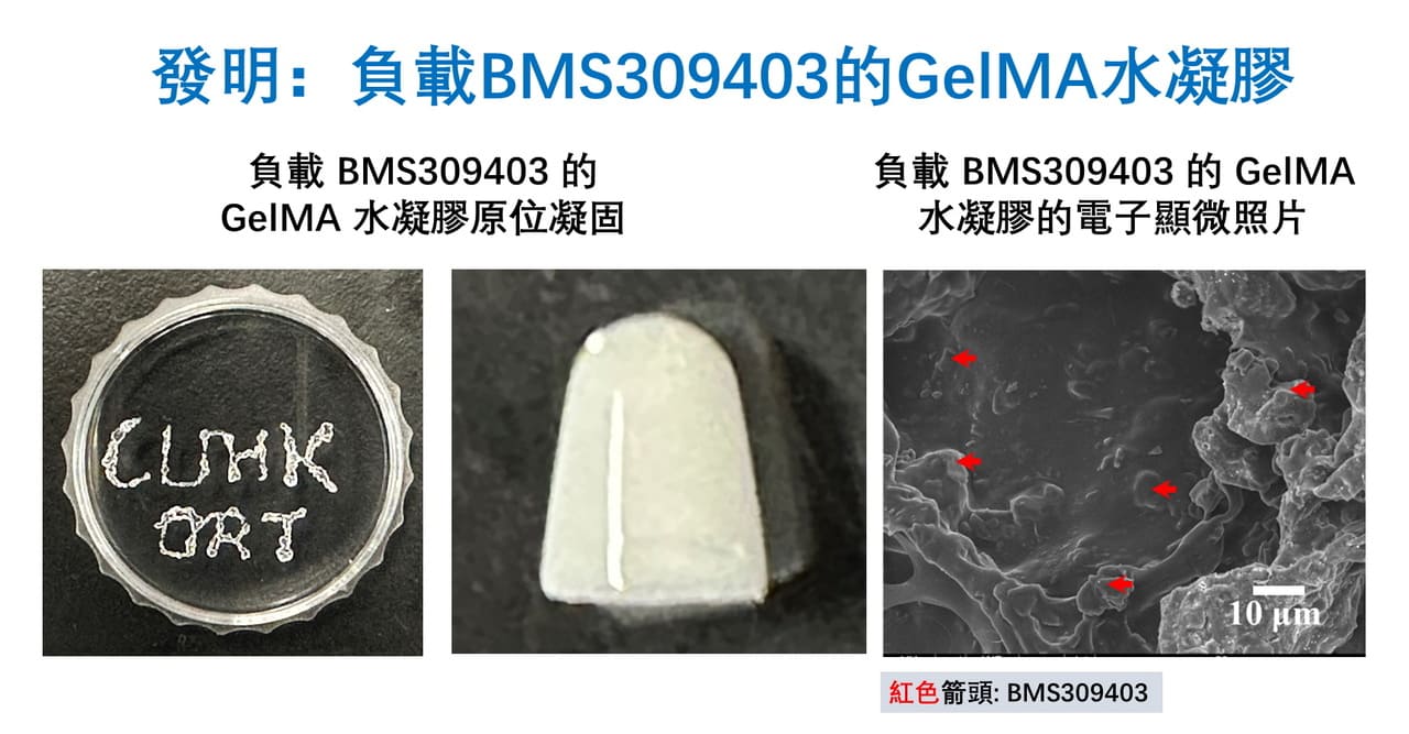 肌腱病的突破性治療:全球首創的可注射型脂肪酸結合蛋白4抑制劑水凝膠