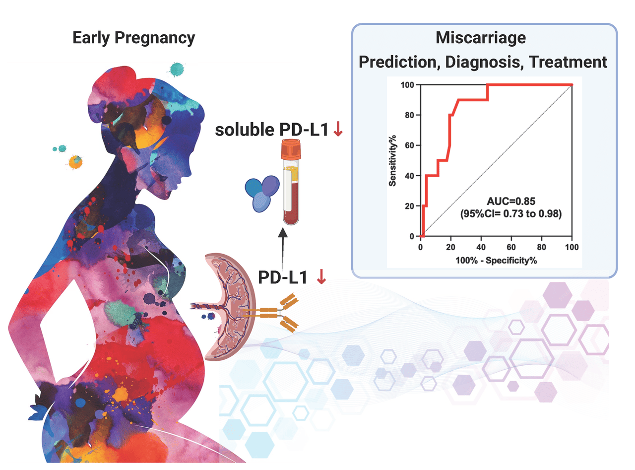 利用血液中可溶性PD-L1促進流產風險預測和診斷
