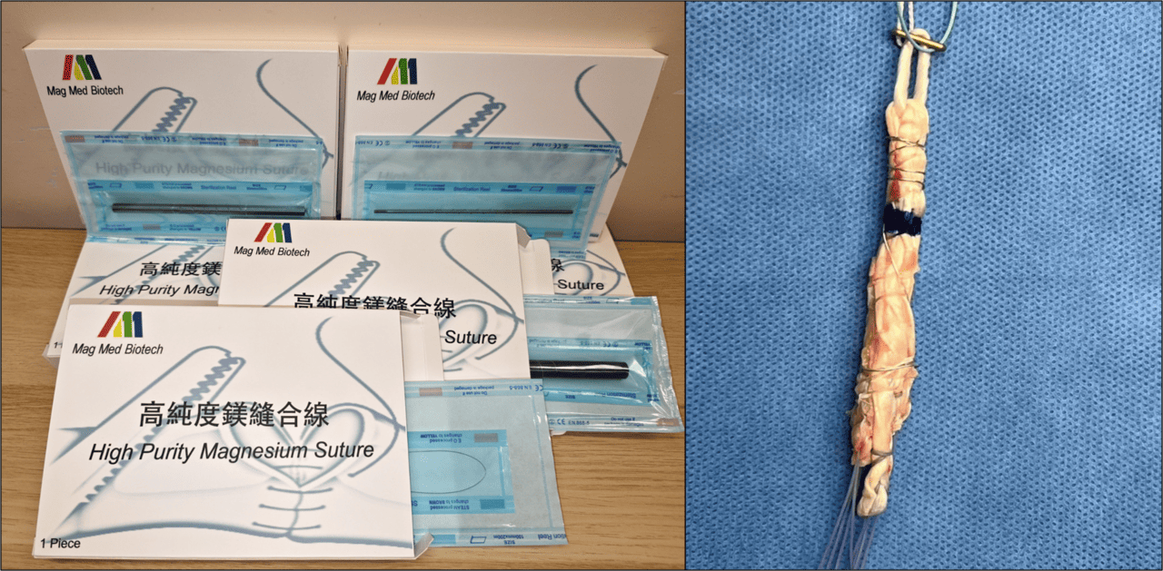 骨骼肌肉再生增強系統