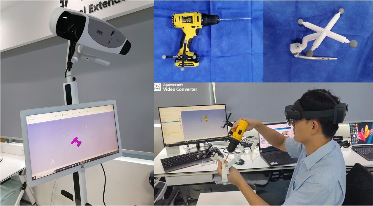 微創性骨折復位超聲波導航系統