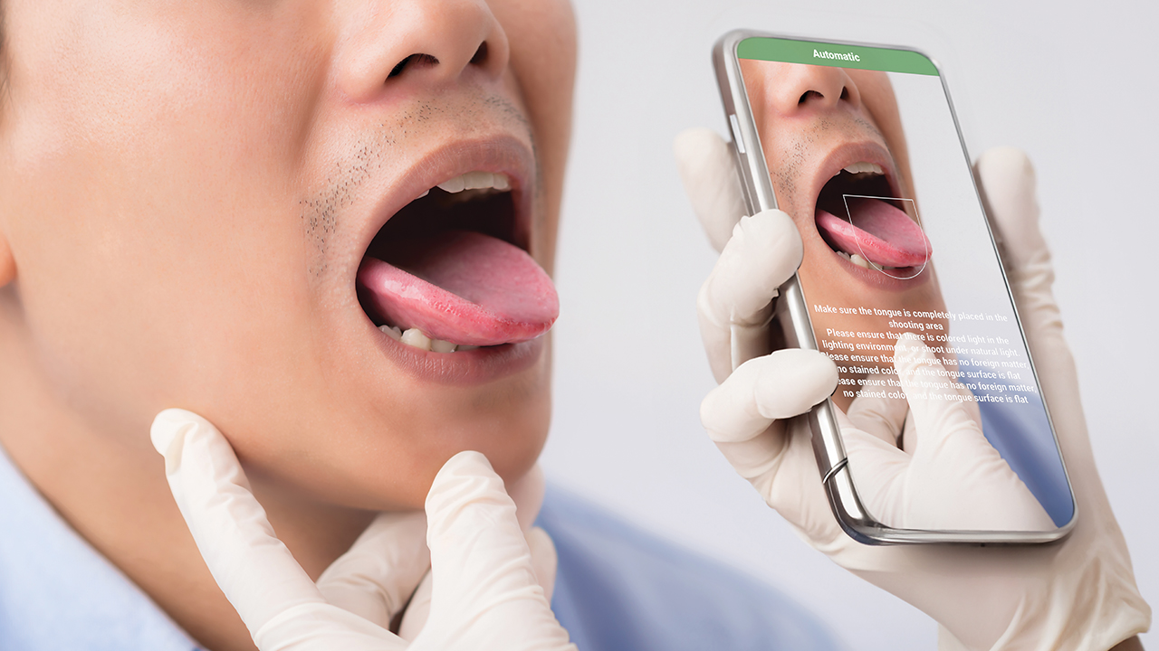 收集與量化舌像特徵的方法與裝置